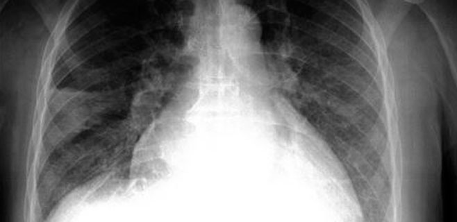 radiologia